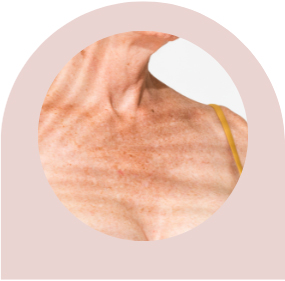 thermage before after nyc