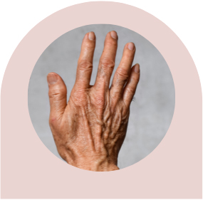 thermage before after nyc