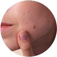 post care instructions for radiosurgery