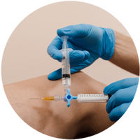 post care instructions for sclerotherapy