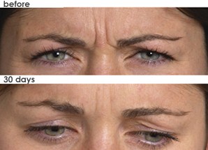 White Plains Westchester